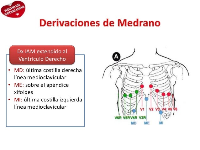 derivaciones de medrano